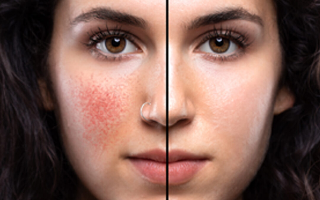 Understanding Sensitive Skin: What Causes It and How to Calm, Strengthen, and Restore the Skin Barrier